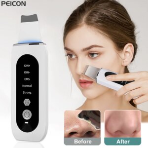 Ultrasonic Skin Scrubber Peeling Blackhead Remover Deep Face Cleaning Ultrasonic Ion Ance Pore Cleaner Facial Shovel Cleanser https://bestebuys.com/shop/ultrasonic-skin-scrubber-peeling-blackhead-remover-deep-face-cleaning-ultrasonic-ion-ance-pore-cleaner-facial-shovel-cleanser/ BestEbuys - The Best Daily Online Deals