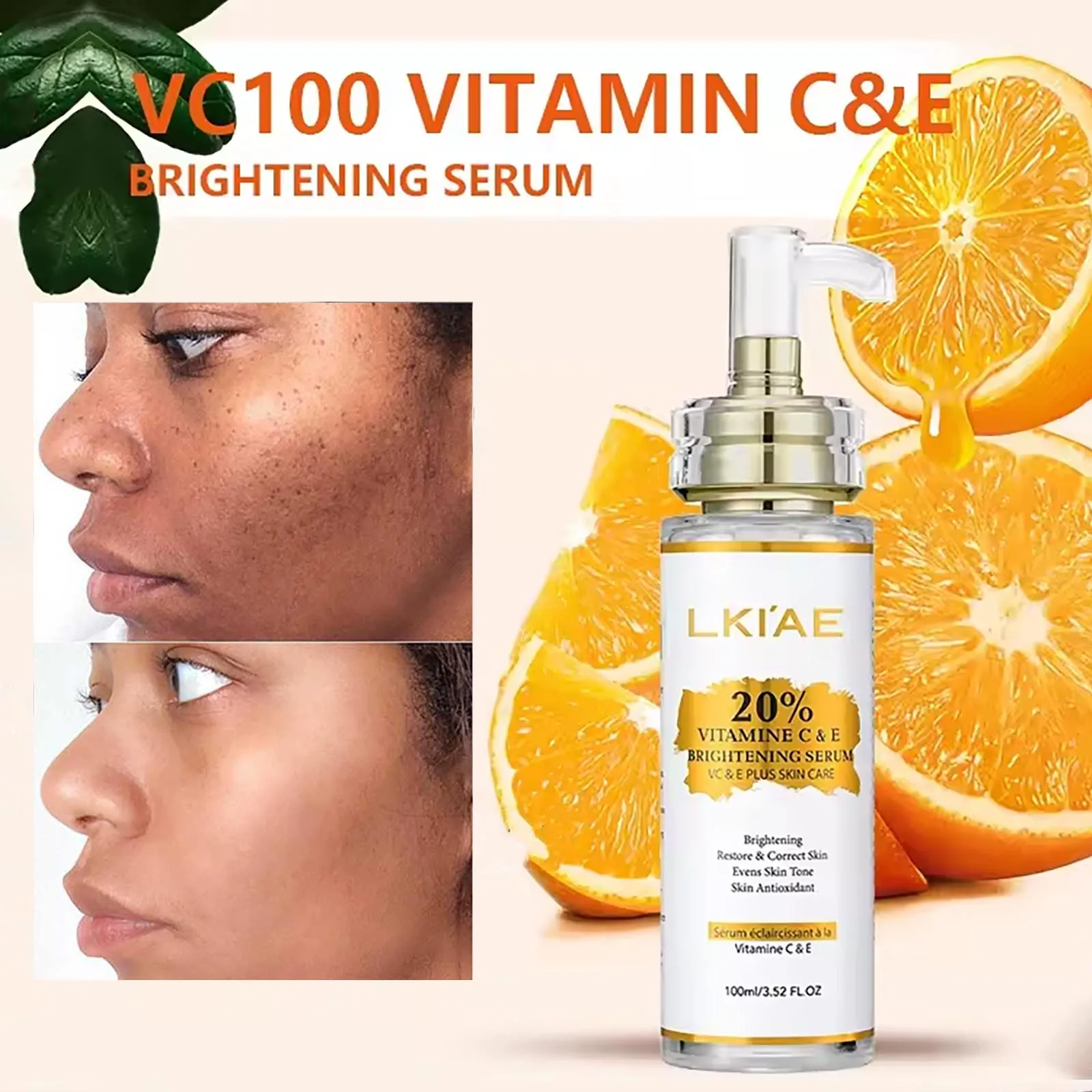 AILKE Vitamin C Skin Care Lightening Body Lotion, Even Skin Tone Cream, Regenerae Serum BestEbuys - The Best Daily Online Deals https://bestebuys.com/shop/ailke-vitamin-c-skin-care-lightening-body-lotion-even-skin-tone-cream-regenerae-serum/