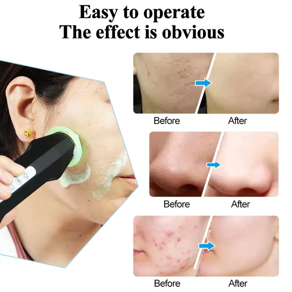 New Portable 360 Degree Rotating Oxygen Bubble Pen CO2 Pods Bubble Skin Rejuvenation and Firming Oxygen Facial Machine BestEbuys - The Best Daily Online Deals https://bestebuys.com/shop/new-portable-360-degree-rotating-oxygen-bubble-pen-co2-pods-bubble-skin-rejuvenation-and-firming-oxygen-facial-machine/ New Portable 360 Degree Rotating Oxygen Bubble Pen CO2 Pods Bubble Skin Rejuvenation and Firming Oxygen Facial Machine BestEbuys - The Best Daily Online Deals https://bestebuys.com/shop/new-portable-360-degree-rotating-oxygen-bubble-pen-co2-pods-bubble-skin-rejuvenation-and-firming-oxygen-facial-machine/