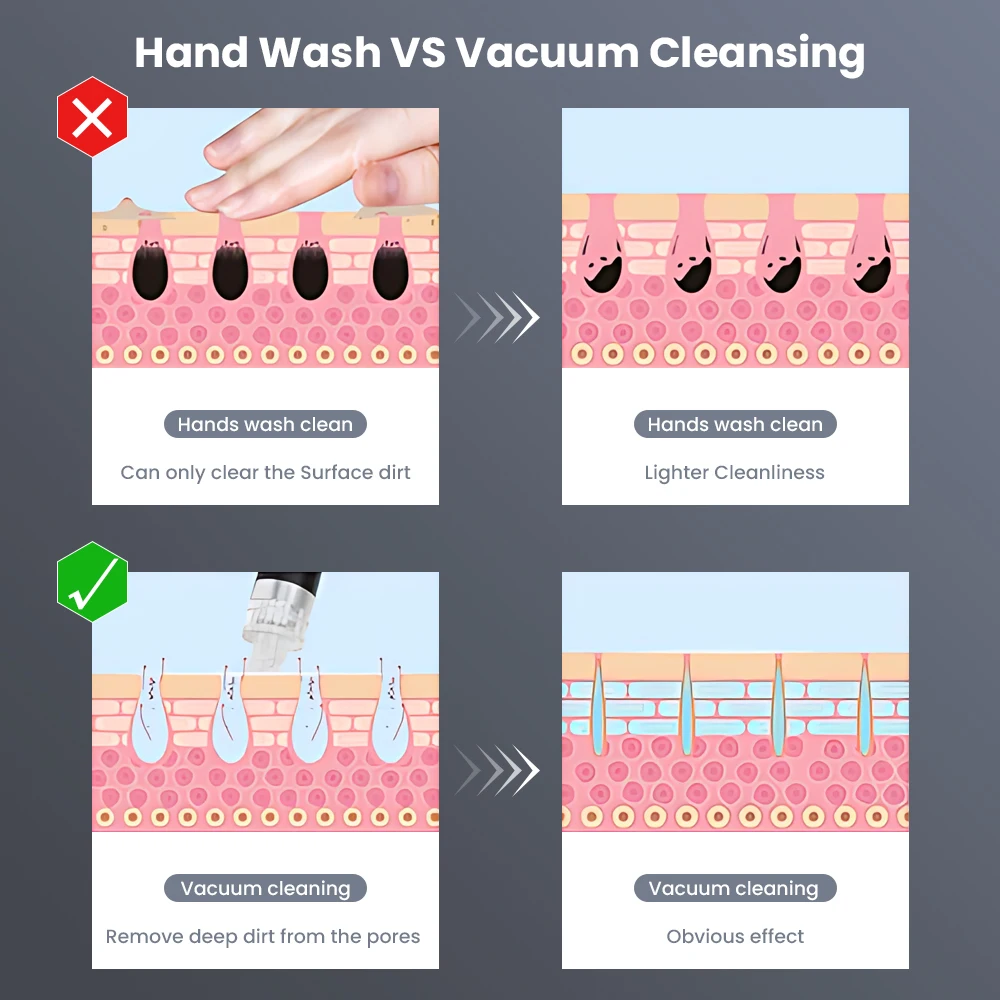 3 In 1 Hydro Dermabrasion Machine Deep Cleansing Machine Facial Clean Dead Skin Removal Spa Facial Microdermabrasion Machine BestEbuys - The Best Daily Online Deals https://bestebuys.com/shop/3-in-1-hydro-dermabrasion-machine-deep-cleansing-machine-facial-clean-dead-skin-removal-spa-facial-microdermabrasion-machine/