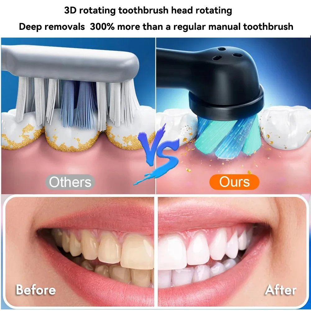 Rotating Electric Toothbrush Black White for Adults with 4 Brush Heads Deep Clean with Rechargeable Power and 2 Min Smart Timer BestEbuys - The Best Daily Online Deals https://bestebuys.com/shop/rotating-electric-toothbrush-black-white-for-adults-with-4-brush-heads-deep-clean-with-rechargeable-power-and-2-min-smart-timer/